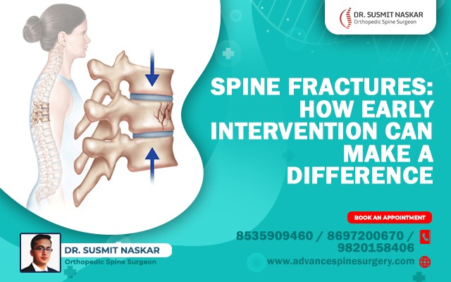Spine Fractures: How Early Intervention Can Make a Difference