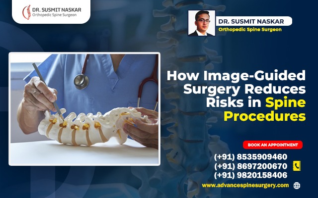 How Image-Guided Surgery Reduces Risks in Spine Procedures