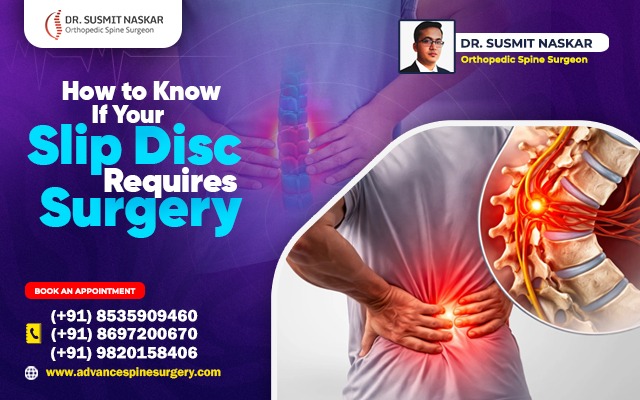 How to Know If Your Slip Disc Requires Surgery